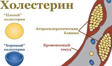 Здоровье от народа: Как снизить холестерин